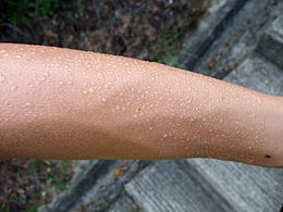 Bezwete arm
