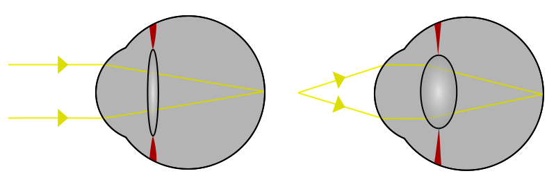 Scherpstelling van het oog