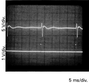 Fig 13